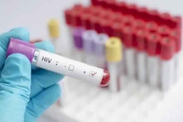 Health officials alarmed by high HIV statistics in Tema metropolis