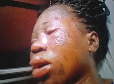 Woman gets bathed with hot water in Lagos