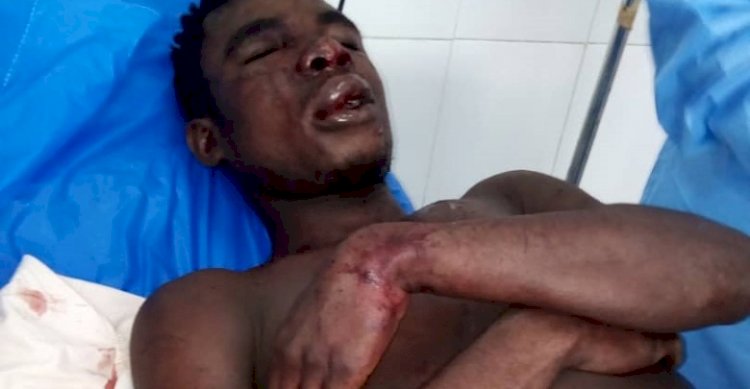 Man Beaten By Mob For Stealing Marijuana In Eastern Region