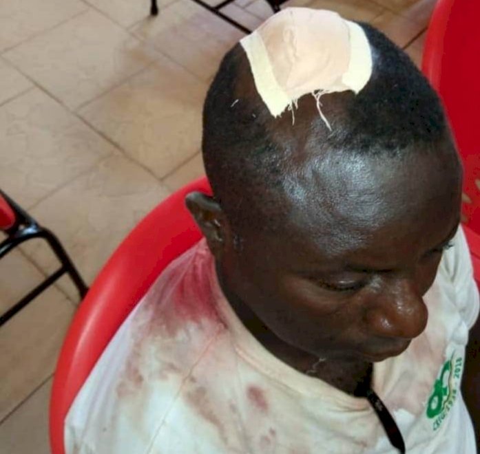 Mechanic Brutalized By Police At Akyem Kukurantumi