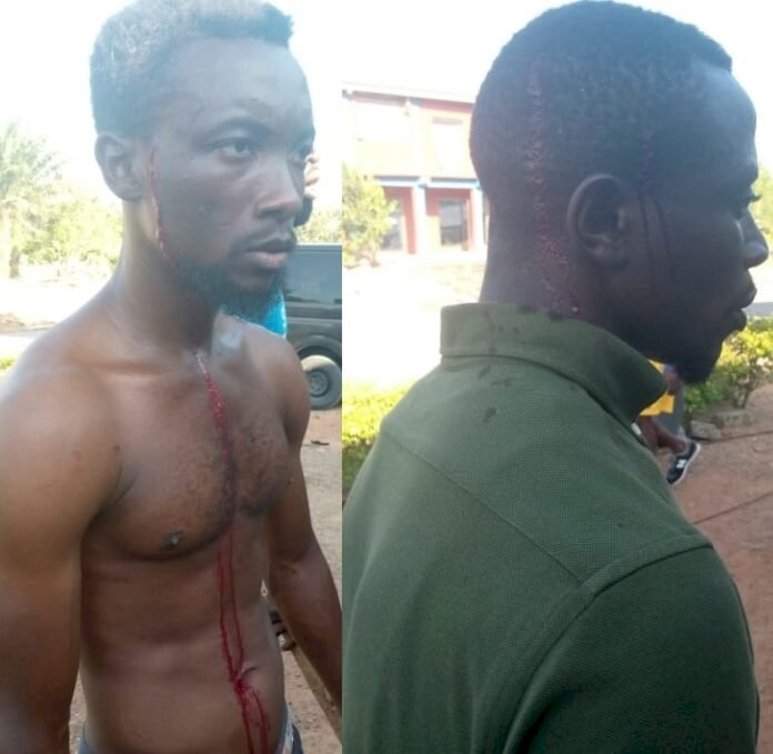 5 Injured After NPP Parliamentary Candidate's Bodyguards Allegedly Attacked Registrants At Ajumako