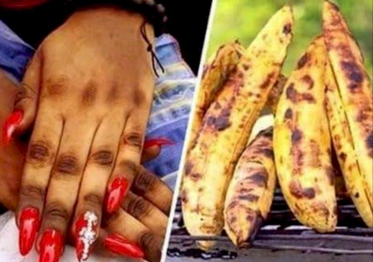 Side Effects Of Skin Bleaching