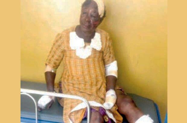 Five Arrested For Inflicting Cutlass Wounds On Alleged Witch In Savannah Region