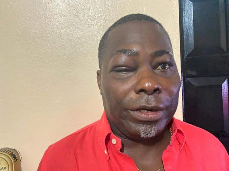NPP's Charles Bissue’s Face Swollen After Fight With Tarkwa-Nsuem MP