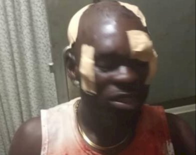 Chieftaincy Clashes Leave 2 With Life Threatening Injuries In Tarkwa