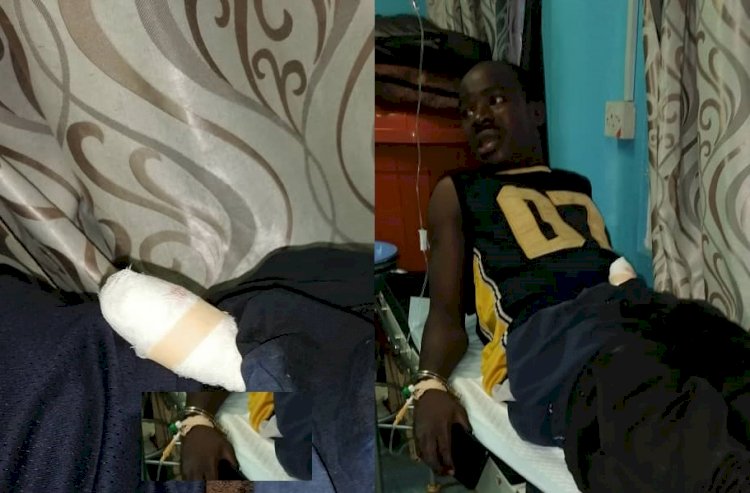 Penis Of An Armed Robber Rapist Bitten Off By Victim While Receiving ‘Blow Job’