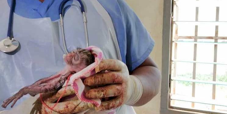 Monkey Delivers Baby Through C-Section At Kumasi Zoo