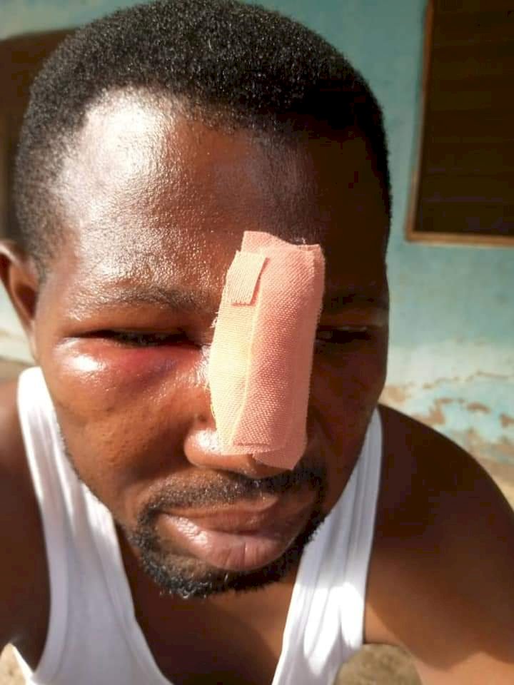 Nungua: JHS Student And Gang Attack Teacher Over Homework