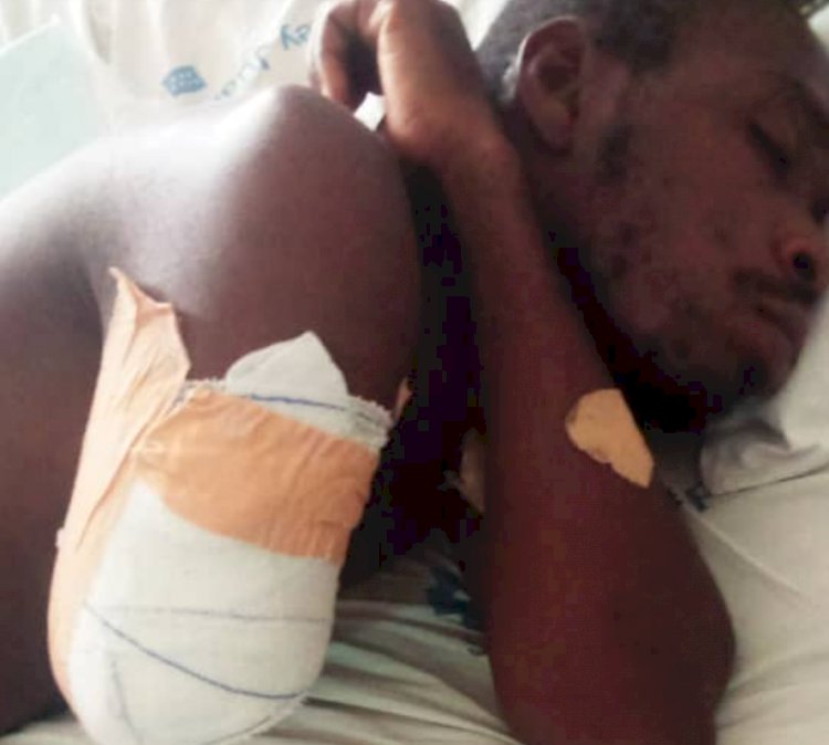 Man Loses Arm After Police Assault At Asutsuare