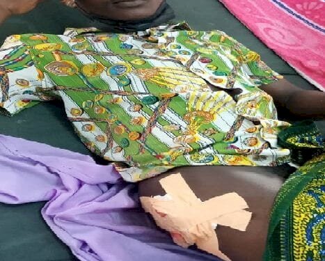 W/R: Mobile Money Vendor Shot By Robbers