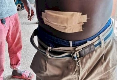 Bawku: Two Persons Sustain Gunshot Wounds, One Dead