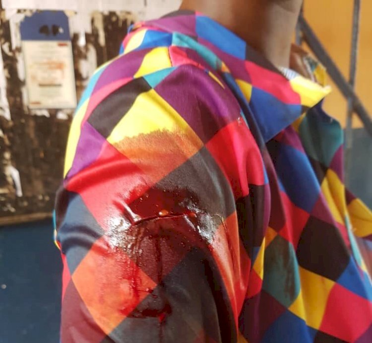 E/R: Man Slashes Girlfriend With Machete Over Misunderstanding