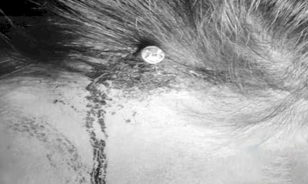 Pakistan: Man Hammers Nail Into Pregnant Woman’s Head To Enable Her Birth Baby Boy