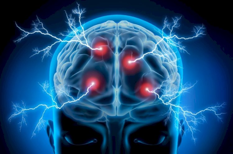 Epilepsy