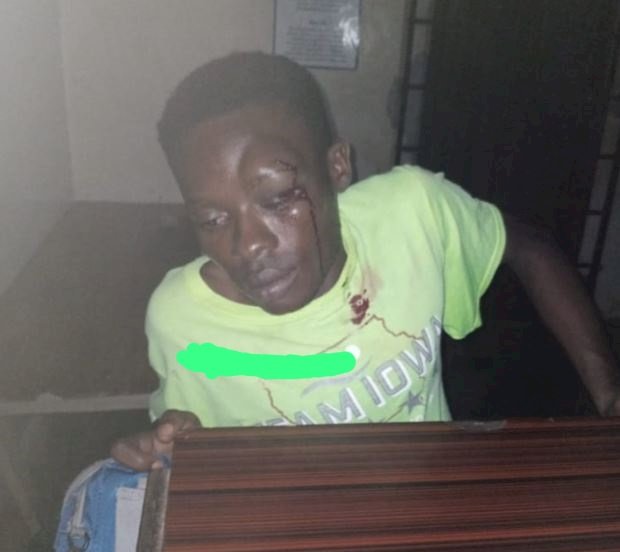 Man’s Eye Nearly Damaged After Assault By Policeman In Agona Odoben