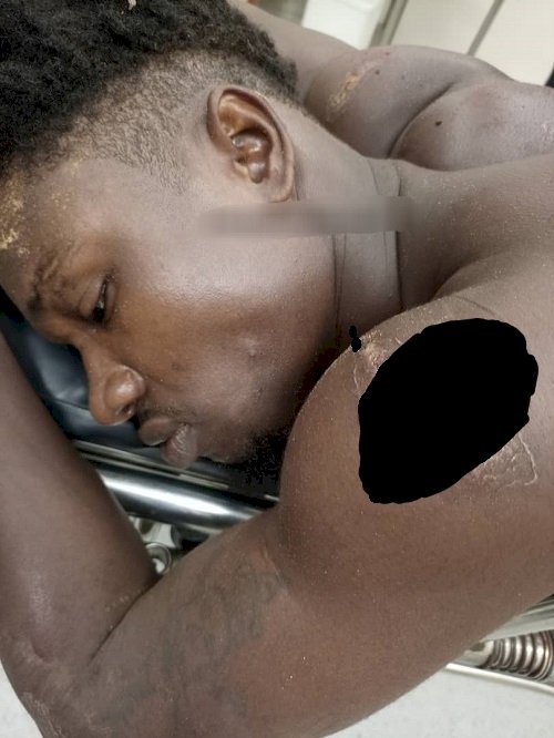 E/R: Robber Shot, Two Others Flee After Gun Battle With Police Officer