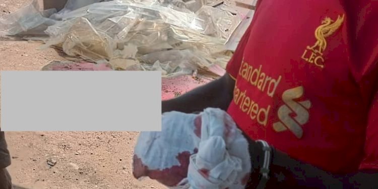 Suspected Land Guards Attack Asafohene Of Toansah