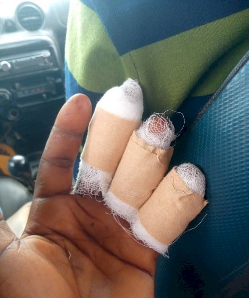 Mason’s Fingers Nearly Chopped Off In Land Guard Attack At Mankessim