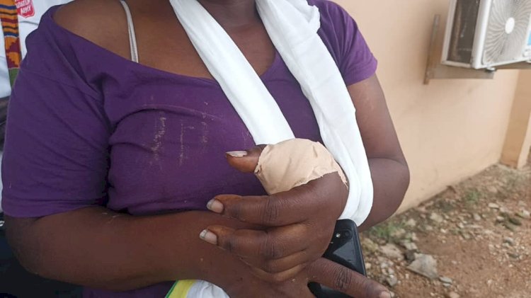 Thugs Slash Woman’s Palm At Gomoa Akotsi