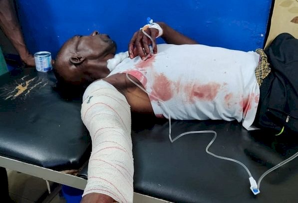 3 Persons Shot By Armed Robbers