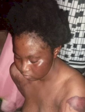 Police On Manhunt For A Man Who Inflicted Wounds On A Woman