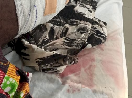 Armed Robbers Shoot MoMo Vendor At Gomoa Akotsi; Bolt With GH₵30,000