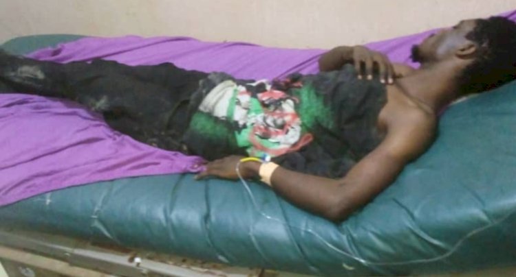 Man Vomits, Urinates Blood After Alleged Police Brutality