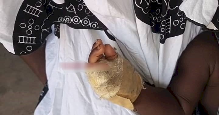 Father Chops Off Son’s Fingers For Money Rituals