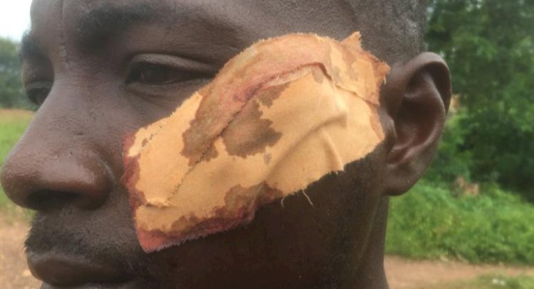 Seven Persons Wounded In Fight Over Woman