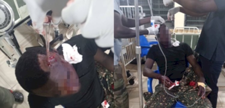 Immigration Officers Attacked By Unknown Men At Aflao Border